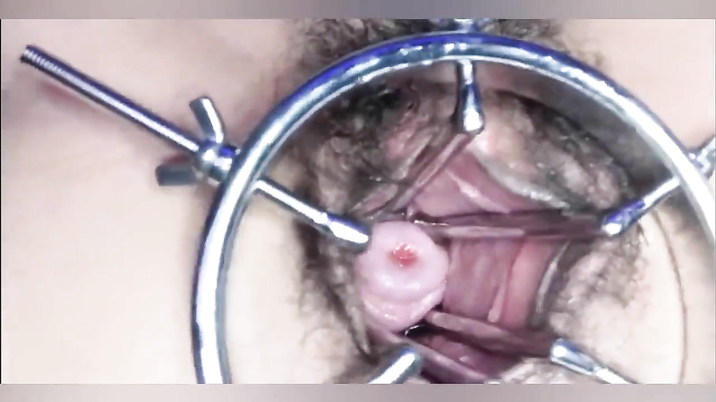 Spreader Pussy Held Wide Open. Cervix Showing. Speculum.