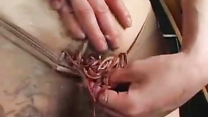 Asian worms