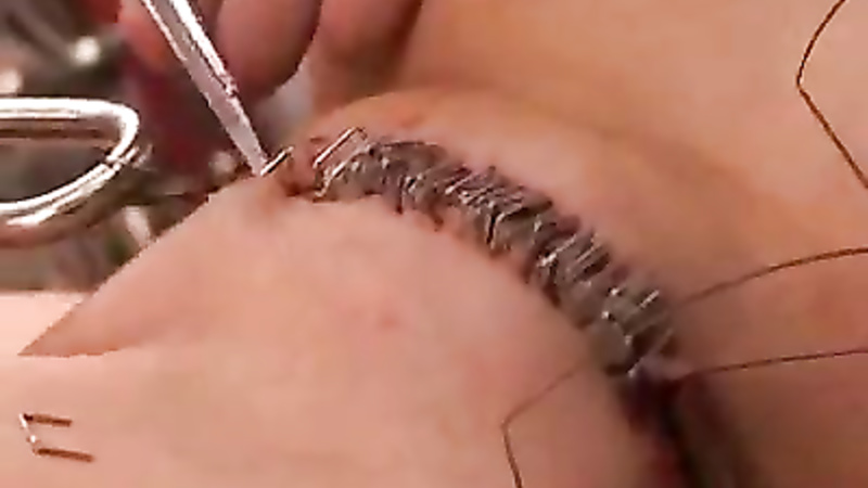 TG pussy sewing and stapling